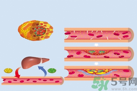 高膽固醇人群該怎么辦？膽固醇高需注意什么？