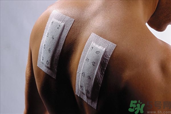 吃栗子過(guò)敏嗎?吃栗子過(guò)敏的癥狀有哪些 吃栗子過(guò)敏嗎?吃栗子過(guò)敏的癥狀有哪些