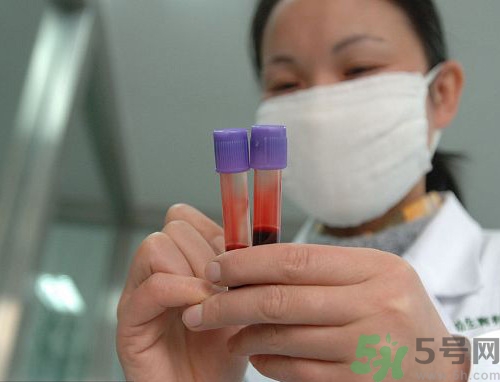 親子鑒定結(jié)果多長(zhǎng)時(shí)間能出來(lái)?親子鑒定結(jié)果怎么看 親子鑒定結(jié)果多長(zhǎng)時(shí)間能出來(lái)?親子鑒定結(jié)果怎么看