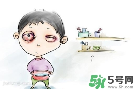 寶寶為什么會感染紅眼病？寶寶患紅眼病如何治療？