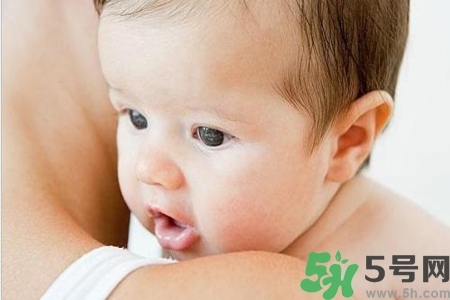 寶寶為什么會感染紅眼??？寶寶患紅眼病如何治療？