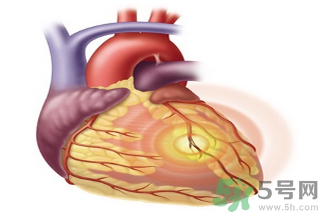 長期酗酒會引起心絞痛嗎？引起心絞痛的原因有哪些？