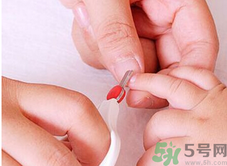 寶寶長(zhǎng)蘚是怎么回事？寶寶長(zhǎng)蘚怎么辦？