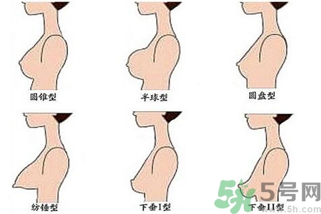 ?女性乳房下垂的原因是什么？女性乳房下垂的分類有哪些？