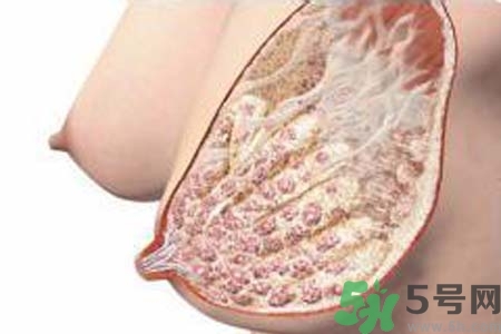 乳腺增生治療方法是什么？乳腺增生的檢查方法有哪些？