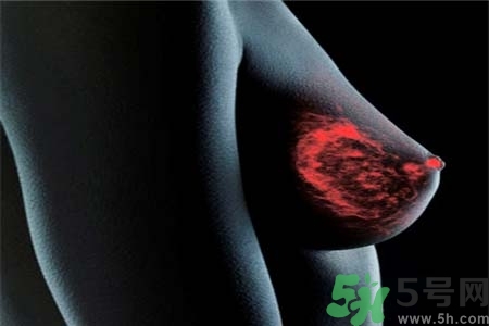 乳腺增生治療方法是什么？乳腺增生的檢查方法有哪些？