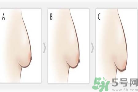 如何預防胸部松弛？吃什么能使胸部挺拔？