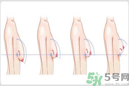 如何預防胸部松弛？吃什么能使胸部挺拔？