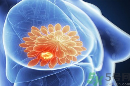 乳房有硬塊正常嗎？乳房有腫塊怎么回事？