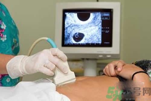 孕婦做b超要空腹嗎？孕婦做b超要不要空腹？