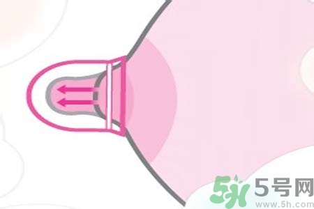 乳頭內(nèi)陷可以用吸奶器嗎？乳頭內(nèi)陷能不能用吸奶器？