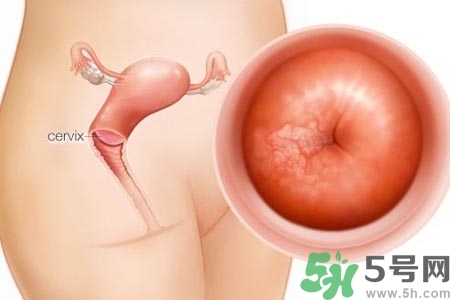 陰道干澀是什么？陰道干澀的危害有什么？