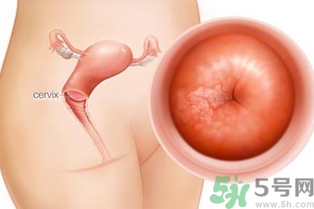 陰道干澀的原因是什么？陰道干澀怎么辦？