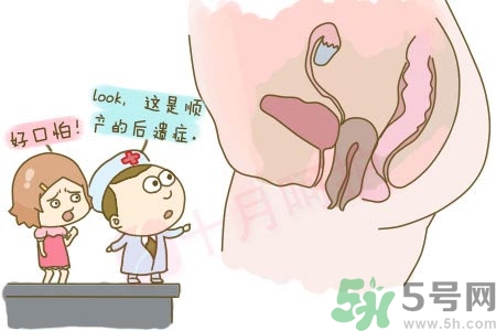 女性陰道松弛的原因是什么？女性陰道松弛怎么辦？