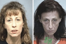 抗衰老的癥狀有哪些？抗衰老的表現(xiàn)是什么？