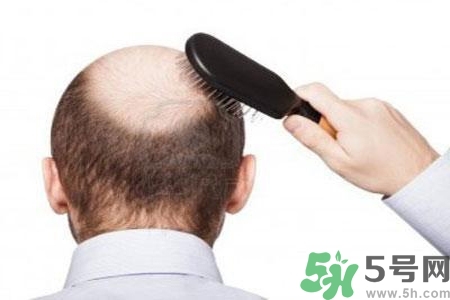 男性防止性衰老決竅有哪些？男性受用一生抵抗衰老法則