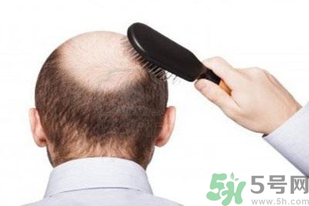 男性更年期的表現(xiàn)有哪些？怎么判斷男性更年期？