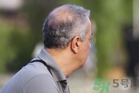 男性更年期的表現(xiàn)有哪些？怎么判斷男性更年期？