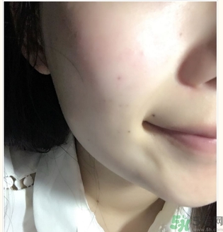 麗得姿面膜適合孕婦可以用嗎？麗得姿面膜哪些孕婦可以用？