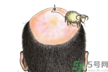 頭發(fā)稀少的原因是什么？如何預(yù)防禿頂?shù)陌l(fā)生？