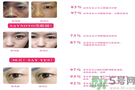 自然之名雪玫瑰雪蒸汽眼霜適合什么年齡？自然之名雪玫瑰雪蒸汽眼霜價格多少？