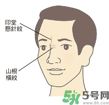 耳垂上有豎紋是怎么回事？山根有橫紋是什么??？