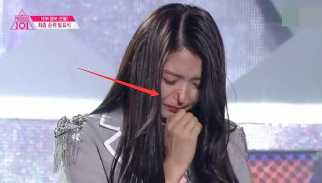 任娜英鼻子塌陷 整容鼻子容易塌陷嗎？