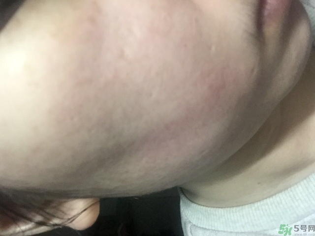 寵愛之名生物纖維面膜用完要洗臉嗎? 寵愛之名生物纖維面膜用完要洗臉嗎?