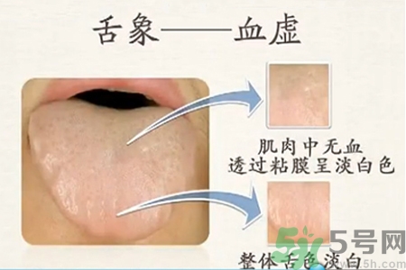 血虛的癥狀是什么？血虛的表現(xiàn)有哪些？