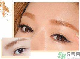 切眉后多久恢復(fù)自然？切眉術(shù)后面部淤青多久才能消？