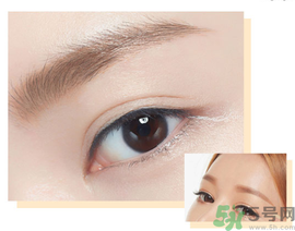 切眉后多久恢復(fù)自然？切眉術(shù)后面部淤青多久才能消？