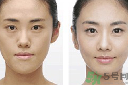 激光縮毛孔多少錢(qián)一次？激光縮毛孔一個(gè)療程多少錢(qián)？