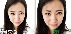 切眉是什么意思？切眉是怎么回事？