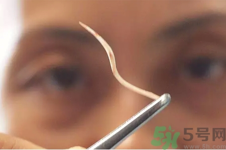 魚刺卡在喉嚨里怎么辦？取魚刺的小技巧有哪些？