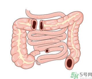 腸炎肚子疼怎么辦？腸炎肚子疼怎么緩解？