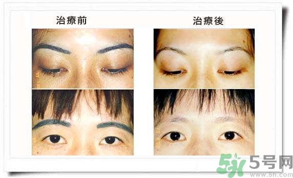 紋眉毛有什么危害？紋眉后注意事項(xiàng)