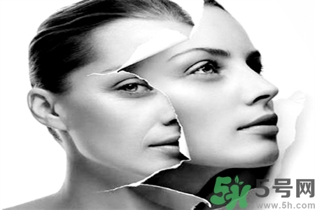 點(diǎn)痣后有紅印怎么辦？點(diǎn)完痣后留下紅印和坑怎么修復(fù)？