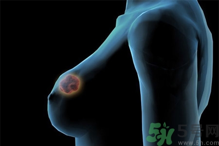 什么是乳溝？乳溝的類型有哪些？?