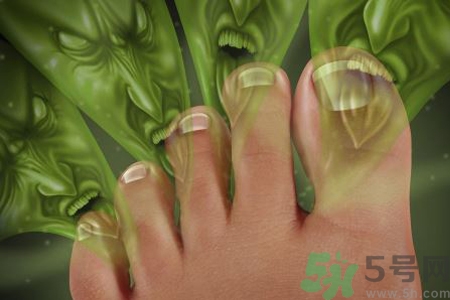 怎么治腳臭？腳臭的原因是什么？