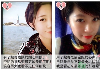 蛇毒眼膜孕婦可以用嗎？ 日本spa蛇毒眼膜孕婦能用嗎？