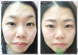 眉毛怎么整形好看？眉毛怎么整自然？