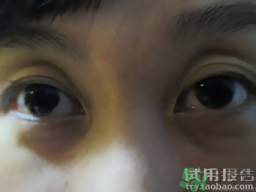 蛇毒眼膜效果怎么樣？spa蛇毒眼膜紅色好用嗎？