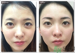 眉毛怎么整形好看？眉毛怎么整自然？