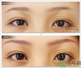 眉毛怎么整形好看？眉毛怎么整自然？