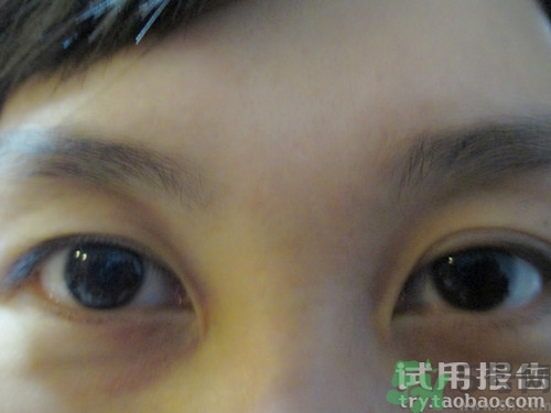 蛇毒眼膜效果怎么樣？spa蛇毒眼膜紅色好用嗎？