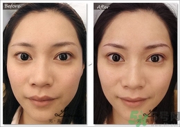 眉毛怎么整形好看？眉毛怎么整自然？