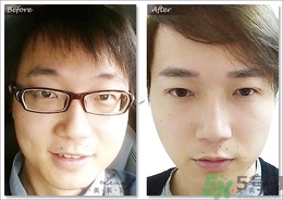 眉毛怎么整形好看？眉毛怎么整自然？