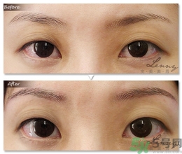 眉毛怎么整形好看？眉毛怎么整自然？