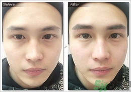 眉毛怎么整形好看？眉毛怎么整自然？