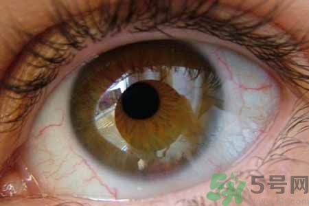 ?干眼癥的治療方法是什么？如何預防干眼癥？